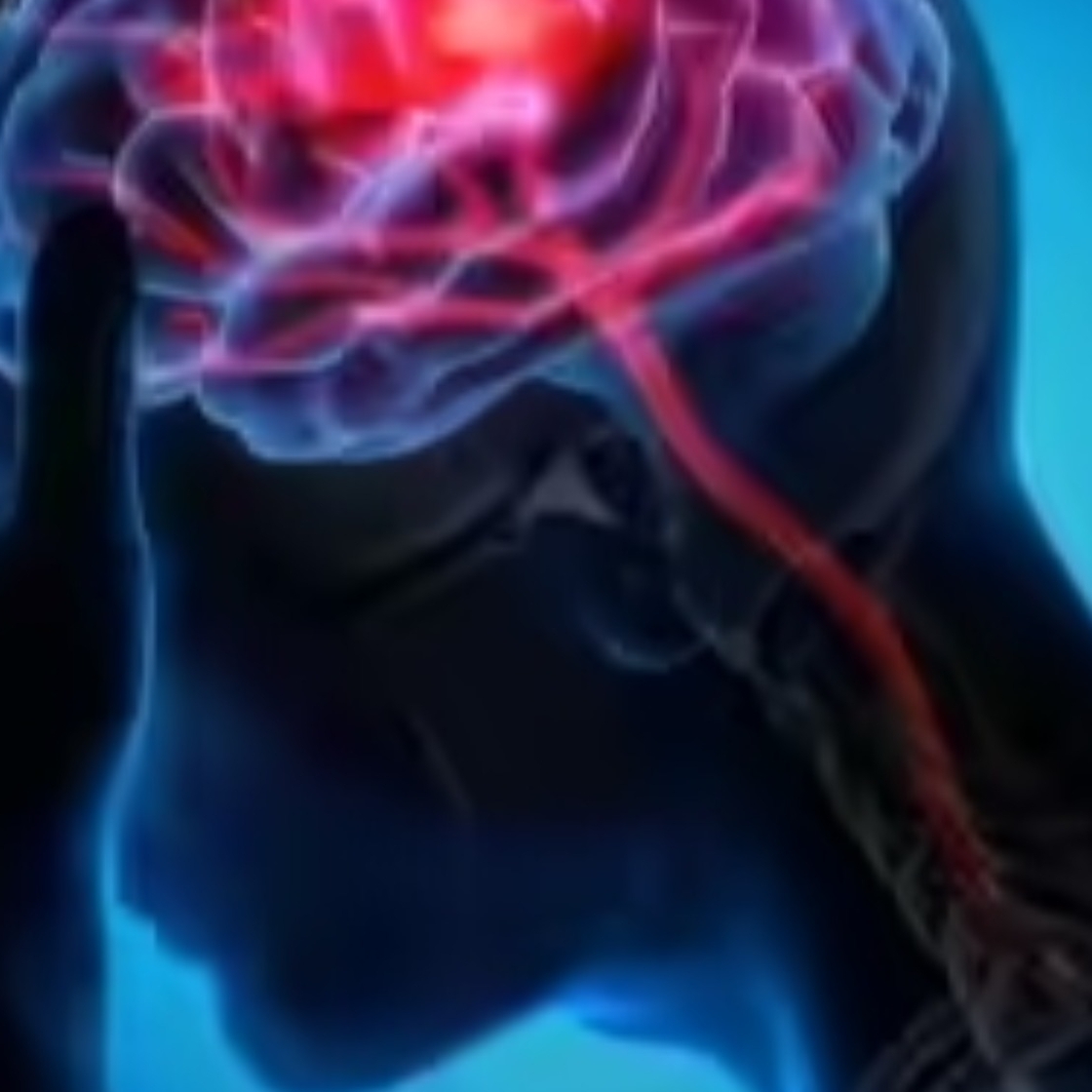 Brainlus Canada
